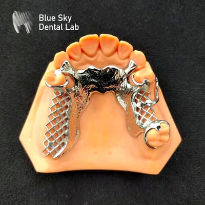 Esqueleto Cromo Dentadura Parcial de Metal Impreso Diseño de Dentadura CoCr