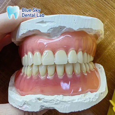 Dentes faltantes Restauración de prótesis dental completa acrílica