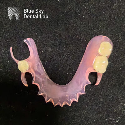 Personalizar Dentadura parcial de acrílico extraíble de aspecto natural Dentadura parcial de valplast