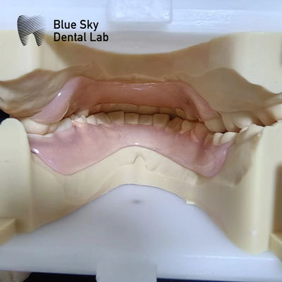 Dentes parciales flexibles de resina Valplast antes y después