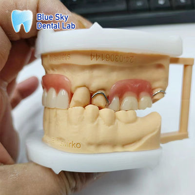 Restauración de la sonrisa Dentadura parcial acrílica con pinzas