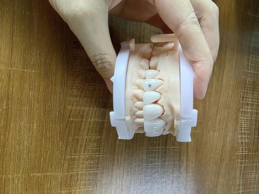 Coroas de zirconia muy translúcidas carillas de puente con joyas personalizadas y oro hermosa caja de restauración dental
