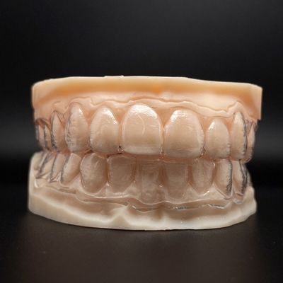 Dientes personalizables alineadores invisibles abrazaderas claras con tiempo de tratamiento más corto